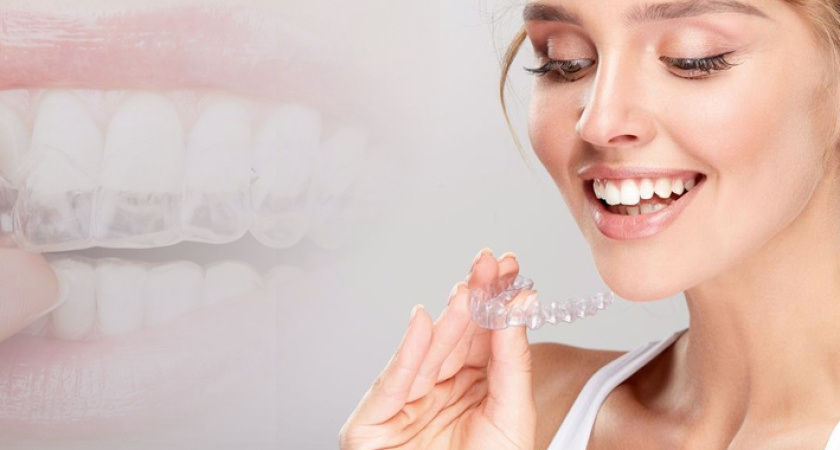 Почему Профессиональное Исправление Прикуса – Ключ к Здоровой Улыбке и Комфортному Пищеварению