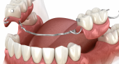 Преимущества частично-съемного протезирования зубов: когда и почему стоит выбрать этот метод
